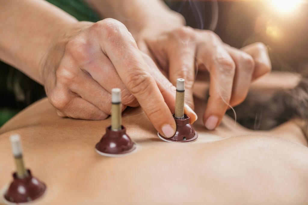 Moxibustion